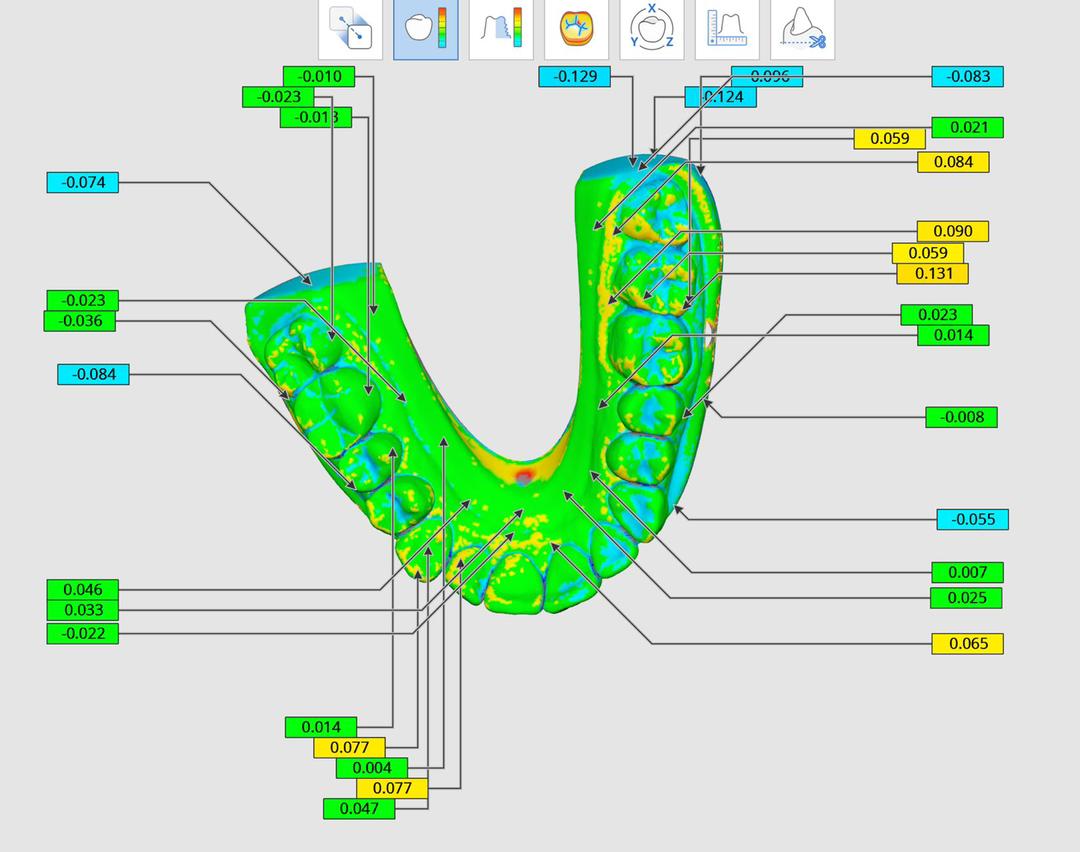 The impact of 3D printer accuracy on the trimming quality for the in-house clear aligner production 