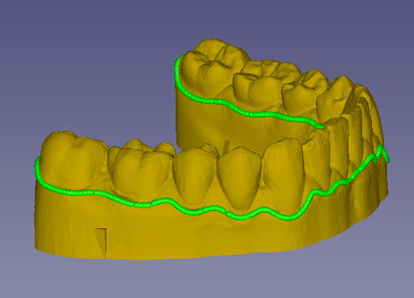 Launch of ‘One Click' Software for Clear Aligner Trimming Machine